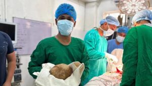 Sri Lankan doctors remove record-sized 3.1kg bladder stone